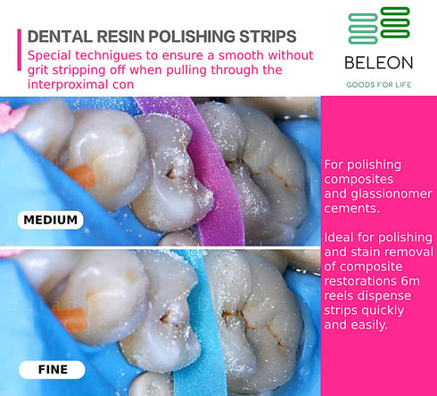 BELEON Dental Polishing Strips - Tooth Polisher Dental File for Teeth Sanding Grinding Deep Teeth Cleaning Tool Tooth Polish Abrasive Strip Oral C...