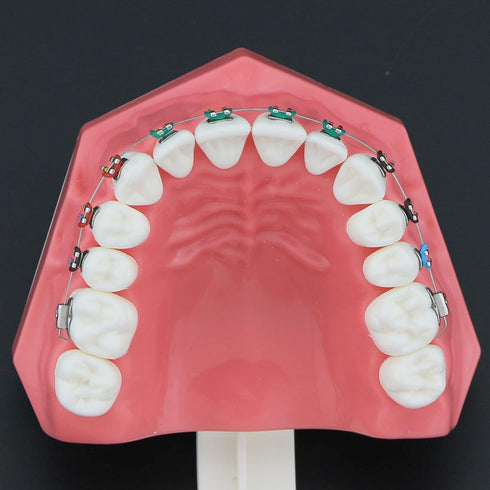 Orthodontic Model Dental Models 1:1 Standard Typodont Teeth Model M7010-2 Demo Teach Study with Archwire Ligature Ties Metal Brackets Buccal Tubes...