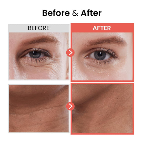 The Skin House Wrinkle Supreme Serum 0.67 fl. oz. Fermented Red Ginseng Skin Rejuvenating Face Serum | Korean Skin Care, K-beauty, 20ml...