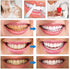 3Pcs Teeth Whitening Pen,Teeth Whitening Gel,Teeth Whitening Essence Pen,Intensive Teeth Stain Remover,Reduce Yellowing Oral Care for Women & Men....