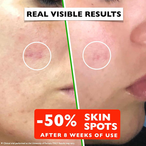 Big 2 Fl Oz. Vitamin C Face Serum. Anti Aging Dark Spot Remover Facial Serum. All-in-One Brightening Vitamin C, Hyaluronic Acid & Vit E Skin Care ...