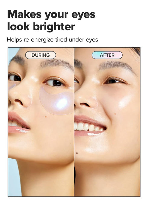 I DEW CARE Hydrogel Eye Patch - Starlit Kitten | Reduce Dark Circles, Fine Line, Pufffy Eyes, Caffein, Hyluronic Acid, Niacinamide, Korean Skin Ca...