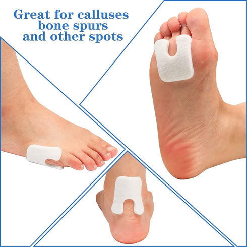 48 Pieces U-Shaped Felt Callus Pads Metatarsal Foot Pads for Pain Relief Keep Calluses from Rubbing on Shoes Forefoot and Support Self-Adhesive Fo...