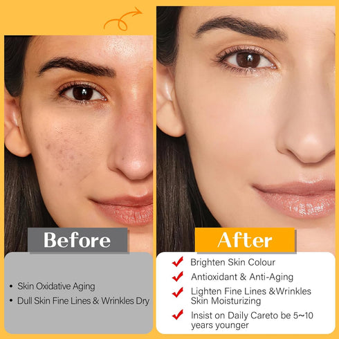 Face Skincare Serum Set– Turmeric Vitamin C & Hyaluronic Acid Serum For Wrinkles, Uneven Skin Tone...