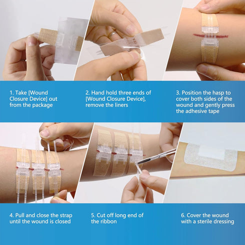 SEABIRD Zip Sutures Wound Closure Device, Emergency Laceration Kit, Bandages with Steri Strips Pack of 2, Painless Laceration Repair without Stitc...