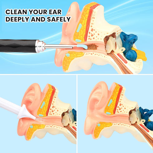 HD Visible Battery Powered Ear Wax Removal Kit, IP67 1080P Camera 6 LED Lights, Ear Irrigation Flushing System with Basin, WIFI Connection Mobile ...