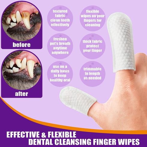 Teeth Cleaning Finger Wipes for Dogs & Cats, Soft Pet Dental Care Wipes, Disposable Pet Tooth Brushing Wipes, Gentle Cleaning & Gum Care Finger Pe...
