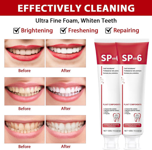 Sp-6 Ultra Whitening, Sp-6 Probiotic Whitening Toothpaste, Ultra Whitening Toothpaste sp6, Probiotic Brightening Toothpaste,Deep Cleaning Care Too...