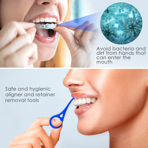 ARGOMAX - Aligner Removal Tool, 5 Invisible Braces Removal Tools, Retainer Remover Tool, Suitable for Removing Braces, Trays, Retainers, Dentures ...