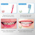 V+A Shaped Orthodontic Toothbrush for Braces, with 6 Interdental Brushes, Soft Bristles, 6 Count...
