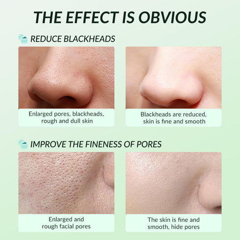 Clay Mask,Clear Skin Cleansing Mud Mask,Clay Facial Mud Mask,Face Masks Skincare Deep Cleansing Blackheads,Minimize Pores,Oil Control,Moisturizing...