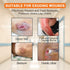 Carbou Silicone Foam Dressing with Gentle Border,4"x4" Adhesive Waterproof and High Absorbency Square Wound Care Dressing Bandage for Pressure Sor...