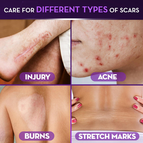 Cicatricure Advanced Scar Gel for Face & Body - Proven Results in 2 Weeks, Scar Treatment for Surgical Scars, Stretch Marks, Scars of Burns and In...
