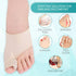 Bunion Corrector and Orthopedic Hallux Valgus Relief Splint Gel Bunion Pads Sleeves Brace – Toe Stretcher Bunion Guard for Men and Women Gel Toe S...