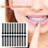 1040 Pcs Black Braces Rubber Bands Orthodontic Ligature Ties O-Rings Elastic Bands for Braces (Black)...