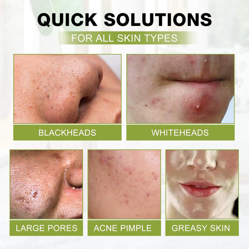 SHVYOG Blackhead Peel Off Face Mask, 3-in-1 Blackhead Remover Mask with Brush & Tea Tree Oil Serum, Charcoal Mask for Deep Cleansing Dirts, Pores,...