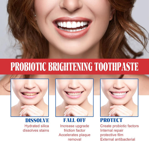Sp-6 Ultra Whitening Toothpaste, Fresh Breath, Stain Removing, Sp-6 Brightening Probiotics Whitening Toothpaste (Red)...