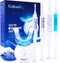 VieBeauti Teeth Whitening Kit - 5X LED Light Tooth Whitener with 35% Carbamide Peroxide, Mouth Trays, Remineralizing Gel and Tray Case - Built-in ...