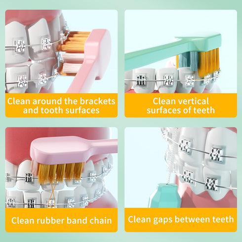 Y-Kelin 2IN1 Orthodontic Braces Toothbrush with interdental Brush...