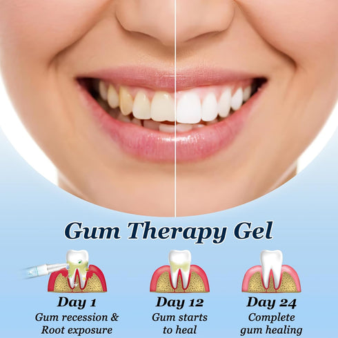 Neslemy™ Gum Shield Therapy Gel,Neslemy Gum Gel,Neslemy Gum Therapy Gel,Gum Instant Treatment Gel,Dentizen Gum Therapy Gel,Teeth Whitening Essence...