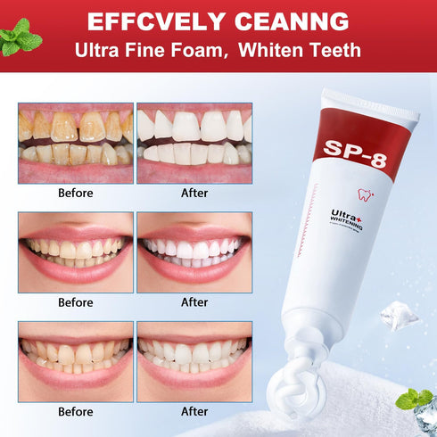 Sp8 Probiotic Toothpaste, Sp-8 Super Whitening Toothpaste, Fresh Breath Removes Tartar, Deep Cleans The Mouth, Care Toothpaste (2PCS)...