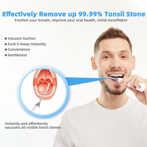 Voraiya Electronic Tonsil Stone Remover Vacuum,10 in 1 Tonsil Stone Removal Kit, 5 Modes Tonsil Stone Cleaner Instant Suction Tool, Easy to Use, F...