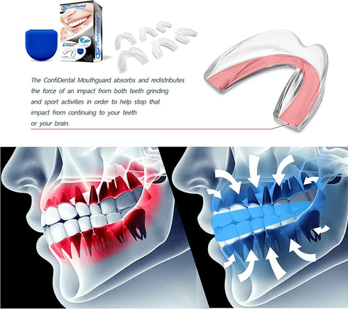 Mouth Guard for Grinding Teeth at Night - Model for Regular Grinding Teeth Pack of 6 Moldable Dental Night Guards for Teeth Grinding and Clenching...