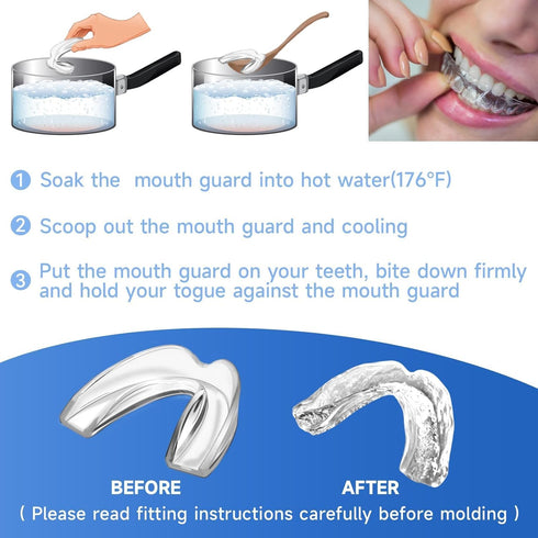 4 Pack Blue Kids Mouth Guard for Grinding Teeth, Moldable Kid Mouth Guard for Clenching Teeth at Night, Comfortable Mouthguard Stops Bruxism, TMJ...