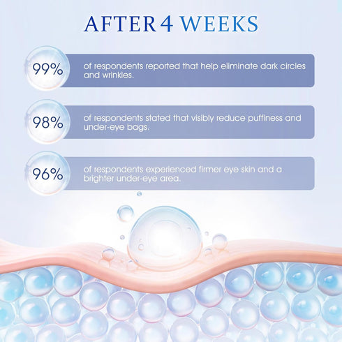 Retinol Under Eye Cream - Anti Aging Eye Cream for Dark Circles and Puffiness, Wrinkles, Fine Lines Eye Bags Treatment Skin Care Hydrates & Lifts ...