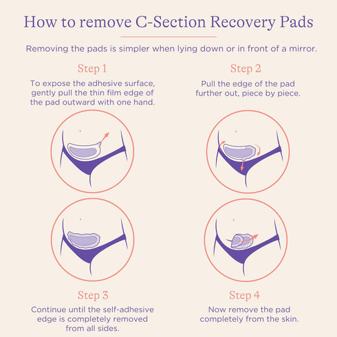 Lansinoh C-Section Recovery Pads, Postpartum C Section Essentials, 4 Sterilized Pads Provide Cooling Relief to Scar Area, C Section Recovery Must ...