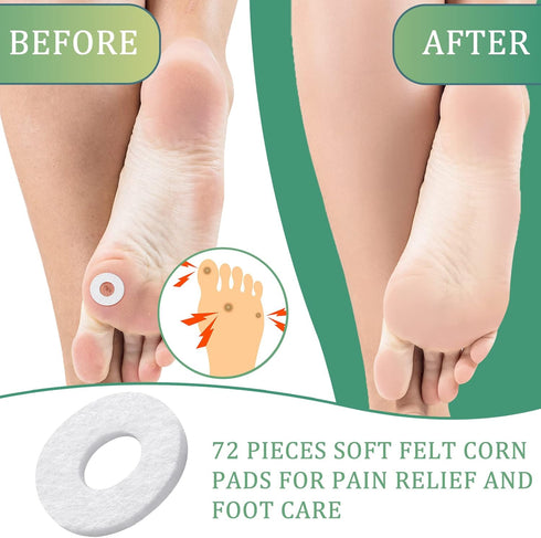 Nuanchu 72 Pcs Callus Cushions Callus Pads for Bottom of Foot Round Corn Cushions Pads for Feet Soft Adhesive Felt Corn Pads for Ball and Side of ...
