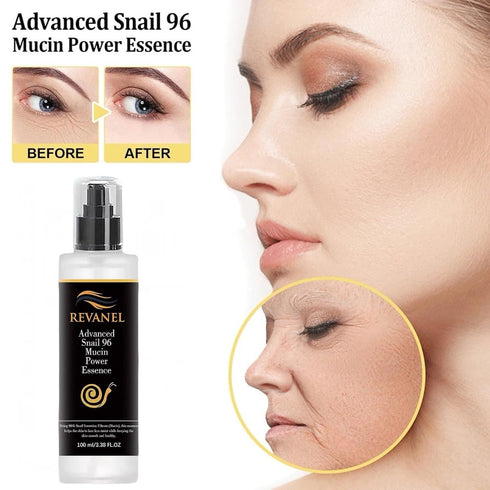 Snail Mucin 96% Power Essence Repairing 3.38 fl.oz 100ml, Hydrating Facial Serum with Snail Secretion Filtrate Mucin for Fine Lines & Dull Skin, K...