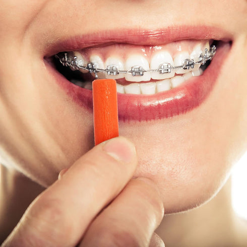 10 Pieces Aligner for Aligner Chompers Aligner Trays Seater Orthodontic Dental aligner(Orange)...