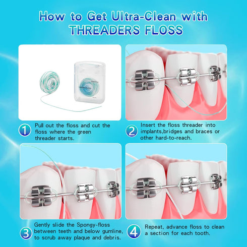 840D Fluffy Floss Threaders,Deep Clean Dental Floss for Braces, Bridges, and Implants,Super Floss Pre-Cut Strands and Mint Aroma,50 Threaders(1Pac...