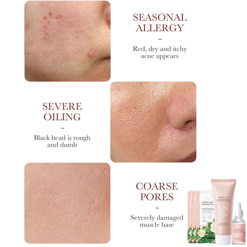 Camellia Extract Skin Care Sets, Skin Care Gift Set for Women Girls, Face Skin Care Routine Kit for Women, 5Pcs Skin Care Products Set with Cleans...