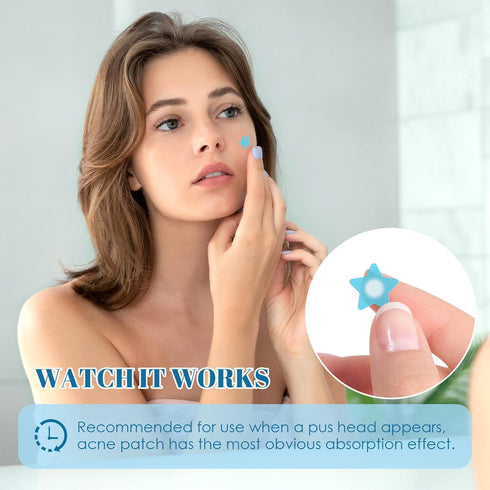 PITHER Pimple Patches for Face, Acne Patches Cute Star Zit Patches Covers for Skin Care, Hydrocolloid Spot Stickers Contain Centella Asiatica, Tea...
