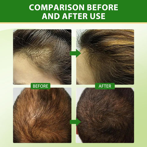 Organic Rosemary Oil Combo for Hair Growth, Discover Natural Hair Care with 1.01fl oz Essential Oils, Ideal for Scalp Massage, Skin Care, and Arom...