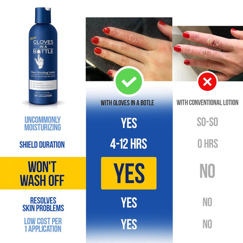 Gloves In A Bottle Psoriasis Eczema Relief Cream - Shielding Lotion for Women, Men, Baby - Cracked Hands Repair Cream - Dermatitis Rash and Itchy ...