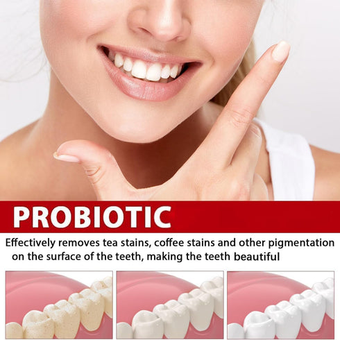 Sp-6 Ultra Whitening, Sp 6 Toothpaste 2pcs?probiotics whitening Toothpaste,Deep Cleaning Care Toothpaste,Fresh Breath Toothpaste Brightening & Sta...