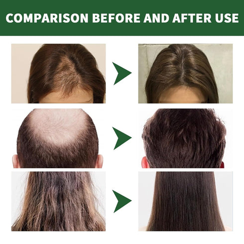 Ginger Hair Growth Conditioner Hair Regrowth Cream Moisturizing Scalp Massage Hair Follicle Hair Care 3.53 oz...