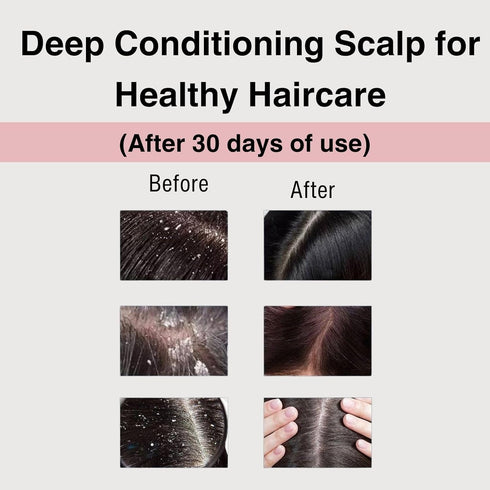 Moist Diane Perfect Beauty Extra Vital Shampoo, Sulfate-Free, with Organic Argan Oil & Vitalizing Keratin from Japan, Rejuvenate Silky Smooth Hair...