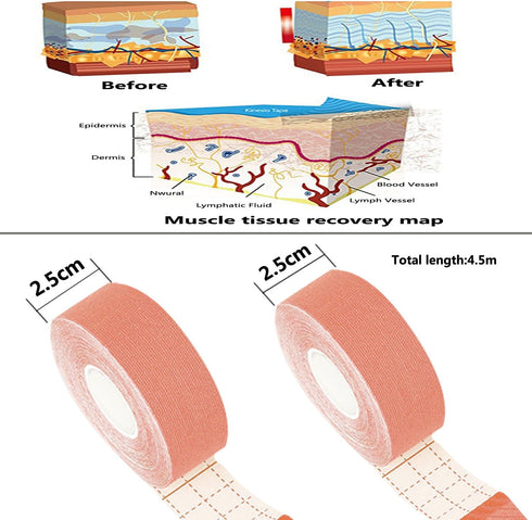FOU Kinesiology Recovery Therapeutic Tape, Waterproof Muscle Support for Athlete,Sports Injury Tape 1 inch x 16.4 ft / 2.5cm x 5m...
