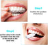 10 Pieces Aligner Trays White Aligner Chompers Orthodontic Trays Seater Original Scent Dental Orthodontic Seater...