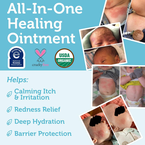 Era Organics Healing Ointment for Babies - USDA Certified Organic Natural Moisturizer Gentle on Sensitive Skin Prone To Baby Eczema, Cradle Cap (I...