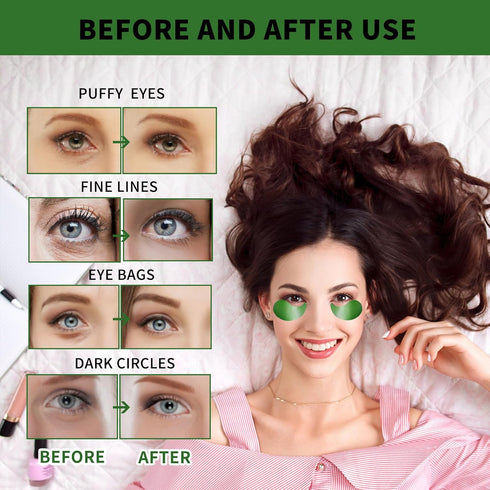 Under Eye Masks for Dark Circles and Puffiness 70PCS, Under Eye Patches for Puffy Eyes Treatment, Under Eye Gel Pads w/Seaweed, Aloe Vera, Peptide...