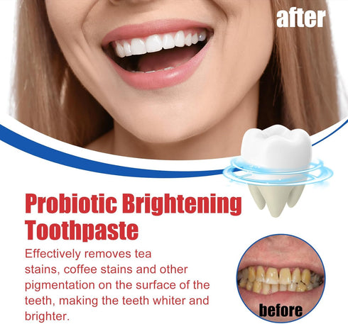 Sp-6 Ultra Whitening Toothpaste, Fresh Breath, Stain Removing, Sp-6 Brightening Probiotics Whitening Toothpaste (Red)...