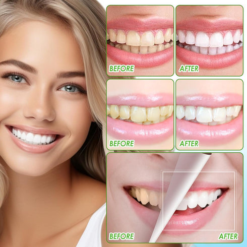 Coconut Oil Pulling Mouthwash Peppermint Ayurvedic with Vitamin D, E, K2, Alcohol Free for Teeth Whitening, Helps with Fresh Breath, Mouthwash for...