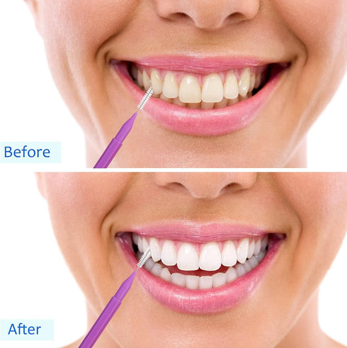 100 Pieces Braces Brush for Cleaner Interdental Brush Toothpick Dental Tooth Flossing Head Oral Dental Hygiene Flosser Toothpick Cleaners Tooth Cl...