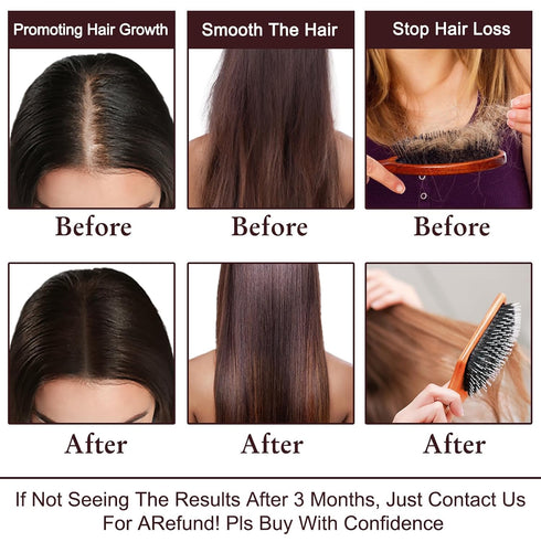 Rosemary Oil Hair Growth Serum w/Hair Growth Shampoo,Biotin Castor Oil Argan Oil Hair Growth Products for Thinning Hair & Hair Loss,Womens Gifts f...