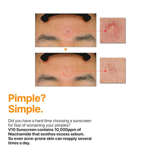 SOME BY MI V10 Hyal Air Fit Sunscreen - 1.69Oz, 50ml - Daily Niacinamide SPF 50 Korean Sunscreen for Face with UV Protection - No White Cast and E...